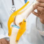 Dor no Joelho | CBT Ortopedia e Traumatologia