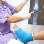 Fraturas Ósseas | CBT Ortopedia e Traumatologia