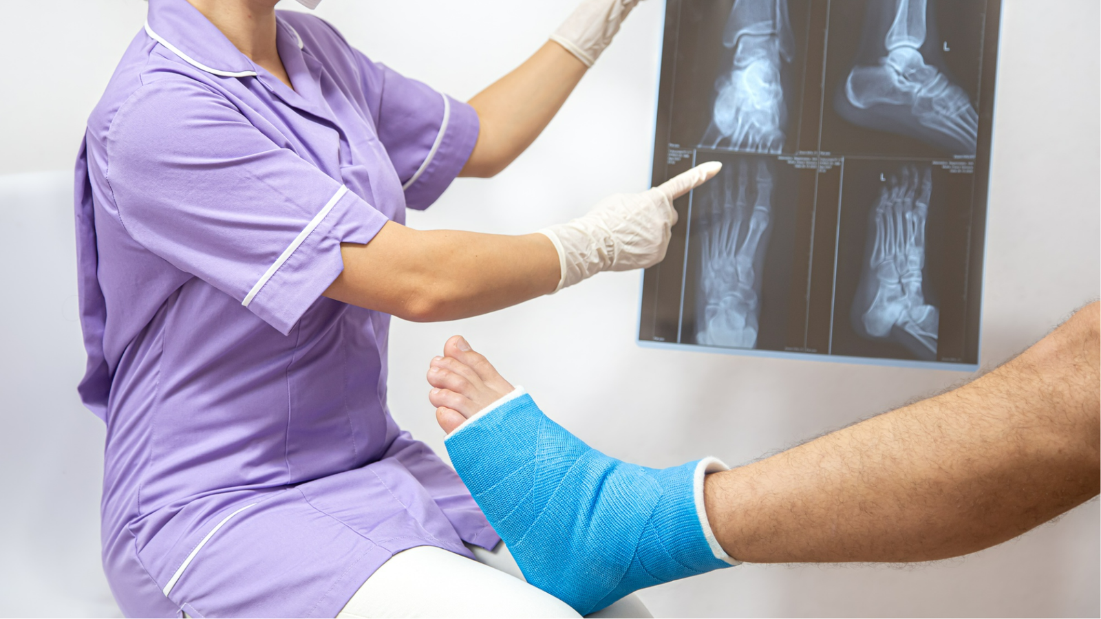 Fraturas Ósseas | CBT Ortopedia e Traumatologia